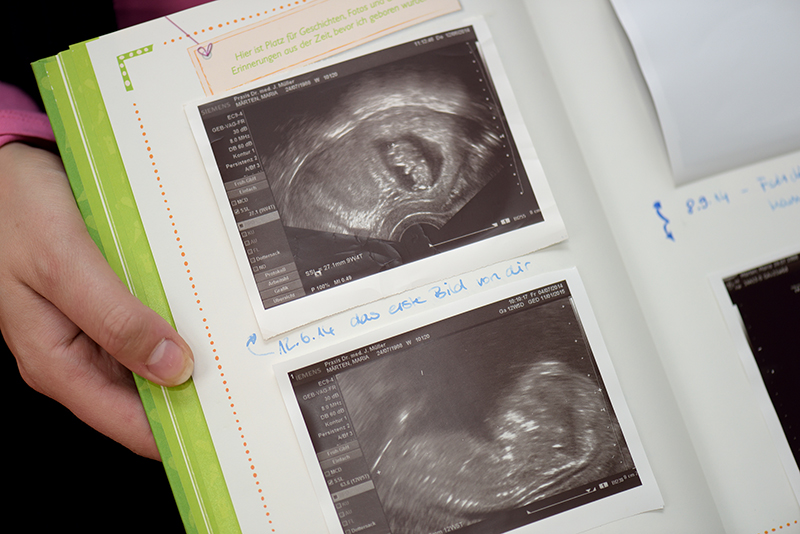 Ultraschallbilder eines ungeborenen Kindes