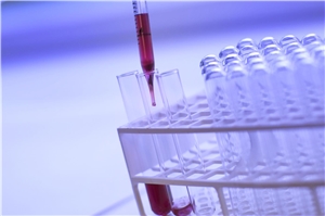 123-2020 Tests Altenheime Das Foto zeigt Teströhrchen.