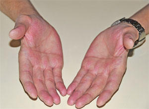 geöffnete leere Hände