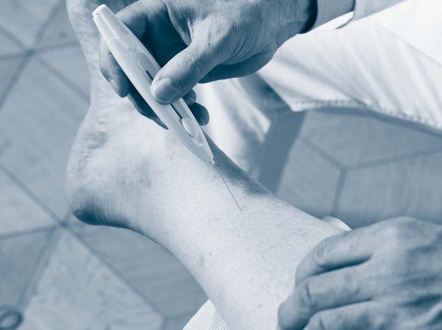 Arzt untersucht Fuß eines Diabetes-Patienten